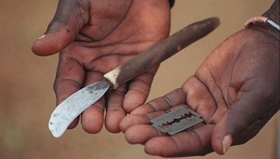 割礼非洲是什么_非洲割礼割的是什么部位_割礼非洲人的割礼是什么意思